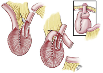 Philadelphia Illustration Dept./Elsevier