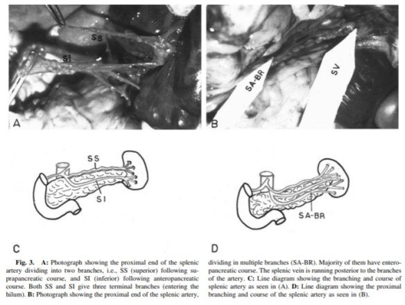 anatomy splenic artery