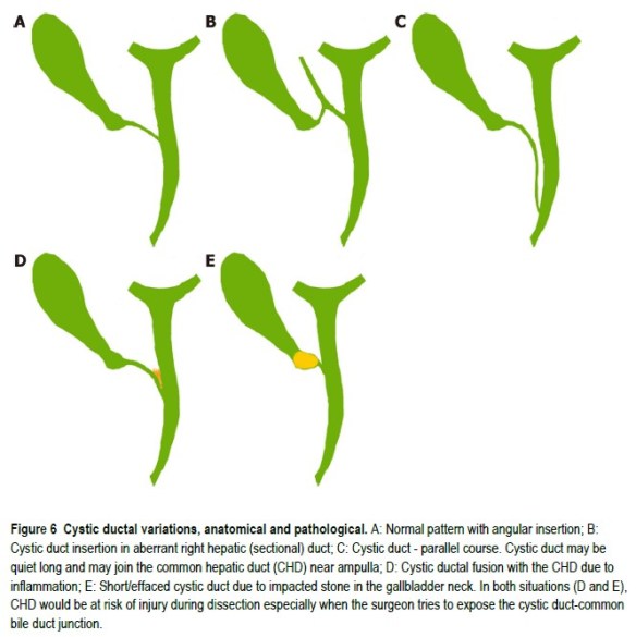 Cystic ductal figures