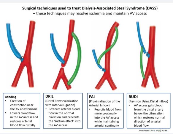 The surgical management and outcomes of dialysis access-associated ...
