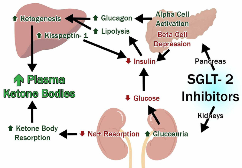 semaglutide sglt2 Sodium-Glucose Cotransporter 2 (SGLT2) Inhibitor Associated Euglycemic  Diabetic Ketoacidosis